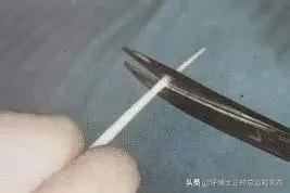 纤维桩修复费用,纤维桩修复全过程视频