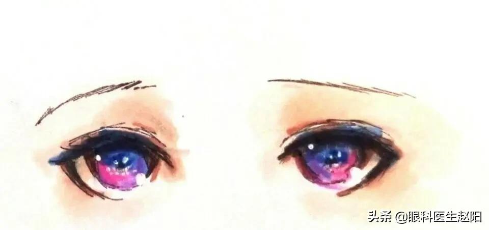 白内障引起后发障怎么办,白内障跟胬肉可以一次解决吗