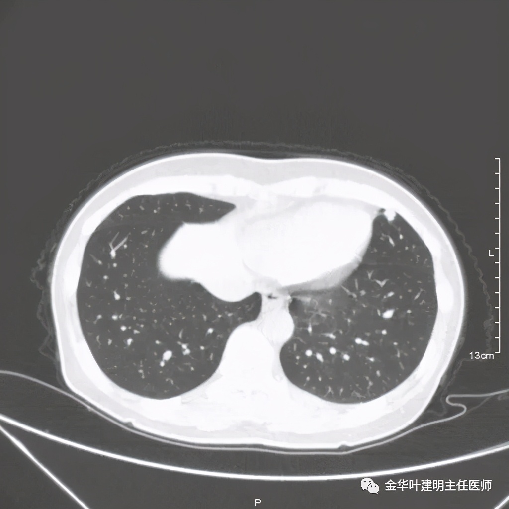 放个大招完整版教学,放个大招完整版前奏