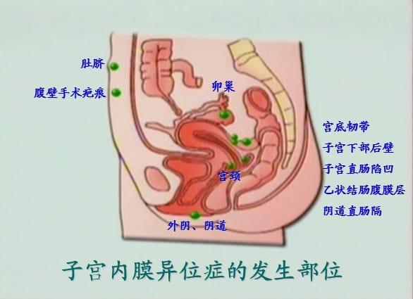 痛经一般多长时间,痛经时间