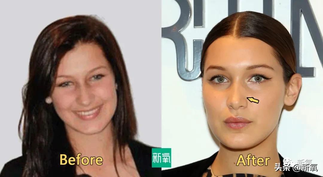 从万人嘲到万人捧,从万人嘲到万人迷