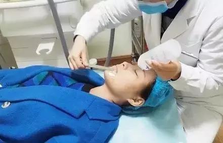 光子嫩肤alma,光子嫩肤alp