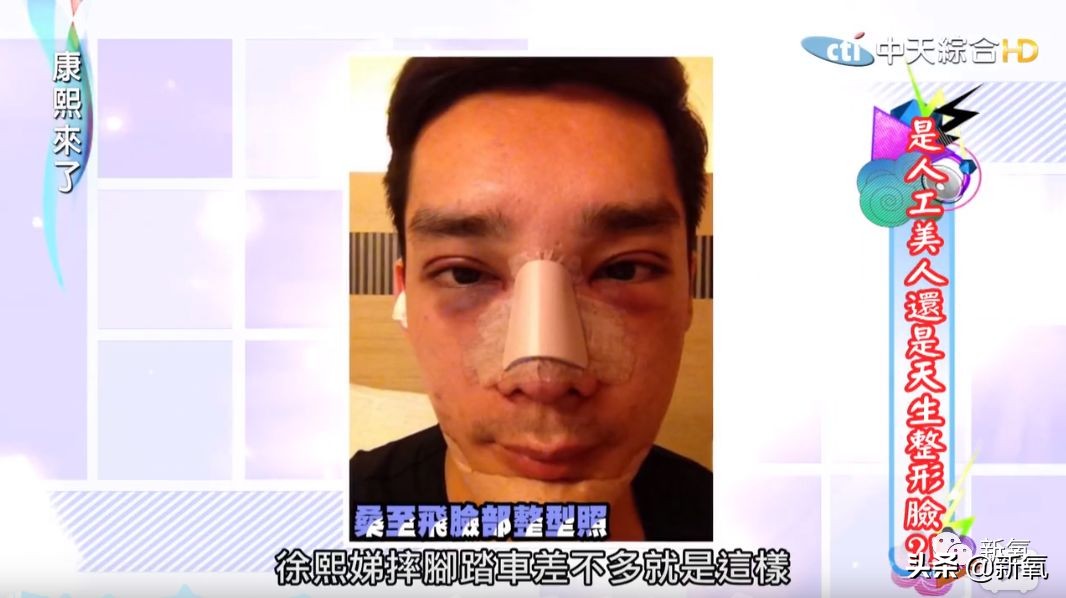 花90万从头整到脚,还可以这么自然?旁边纯天然小姐姐都看懵了