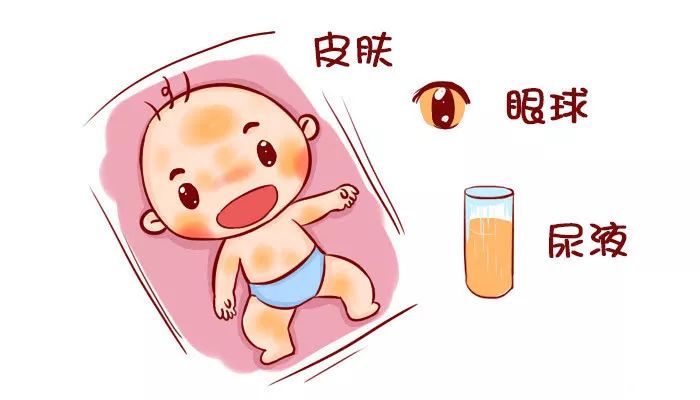 小孩子黄疸可以通过晒太阳治疗吗?