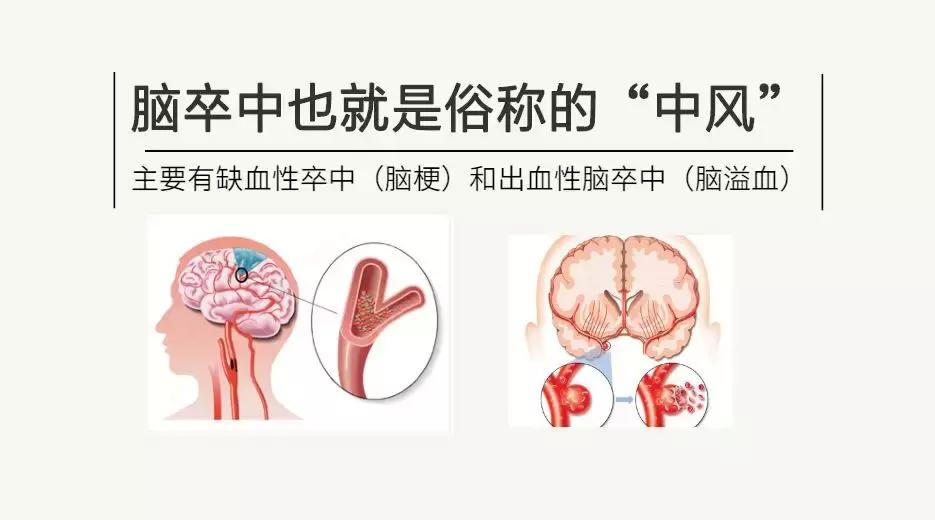 脑中风属于心脑血管性疾病吗,脑中风后遗症和轻微脑中风的区别
