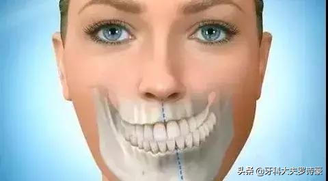 单侧咀嚼矫正后的危害,单侧咀嚼的危害