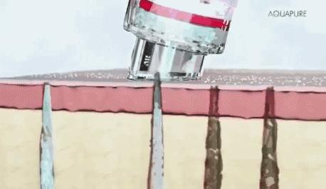 88元的小气泡,80元小气泡