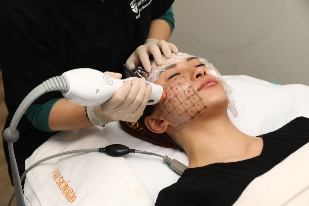 热玛吉仪器打假,热玛吉价格乱象