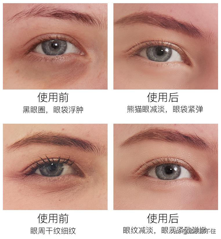 兰蔻抗皱纹眼霜,兰蔻第七代抗蓝光眼霜