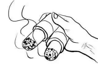 青少年近视艾灸哪些穴位,赵氏雷火灸治近视