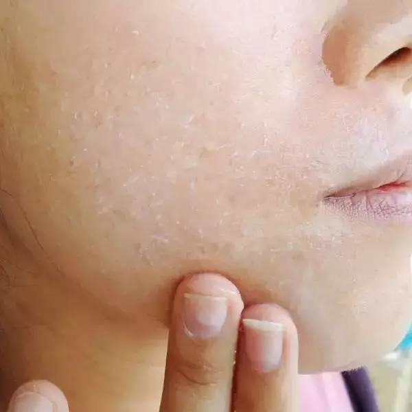 化妆如果已经搓泥了怎么补救呢,底妆会搓泥用什么化妆