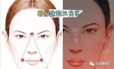 长痘了用什么挤痘痘,痘痘白色的东西挤还是不挤