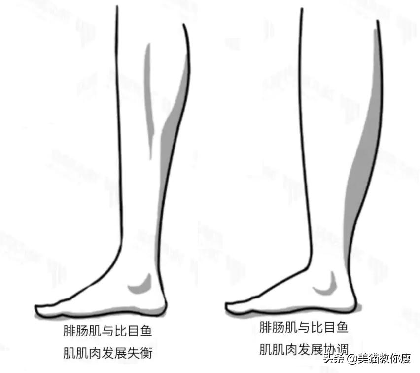 小学生肌肉腿怎么瘦成筷子腿,三天肌肉腿瘦成筷子腿