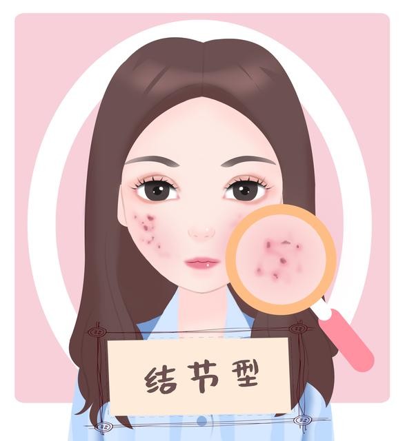 青春痘的中医辨证及治疗,青春痘的中医疗法视频