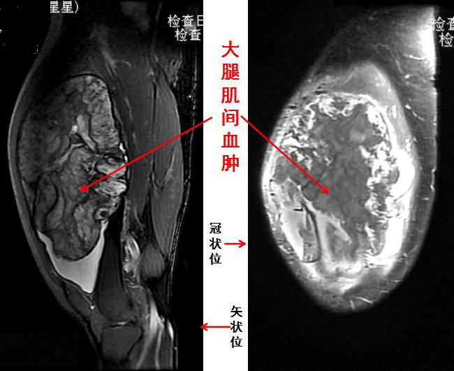 什么是癌症病理学,什么是癌症中医治疗