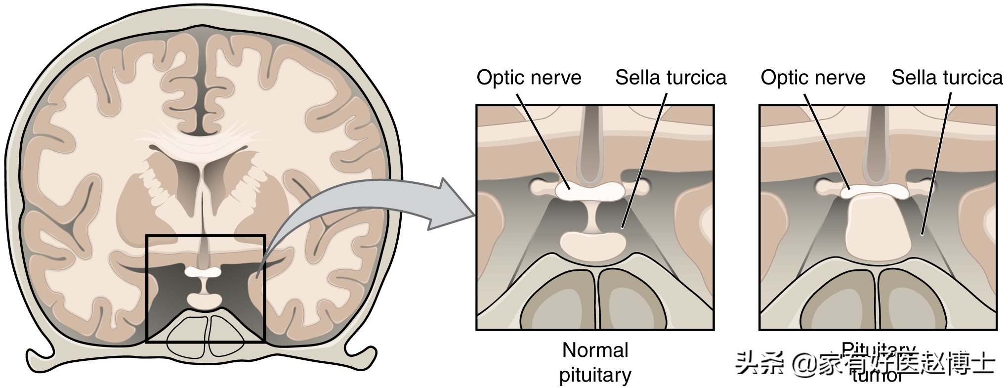 被称为“生理助眠剂”的褪黑素普通片,为何不少人口服效果不佳?