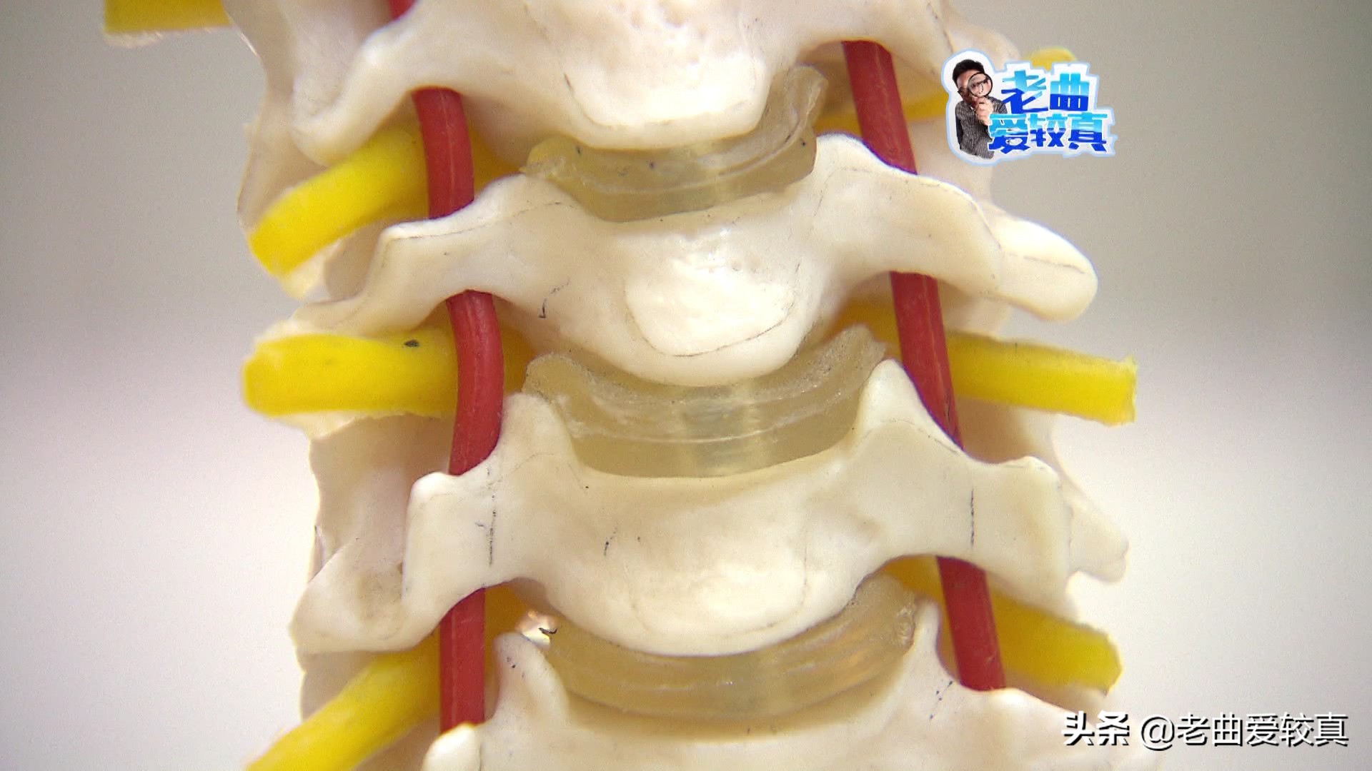 枕瓶子真的能治好颈椎病吗,酒瓶子当枕头可以治疗颈椎病吗