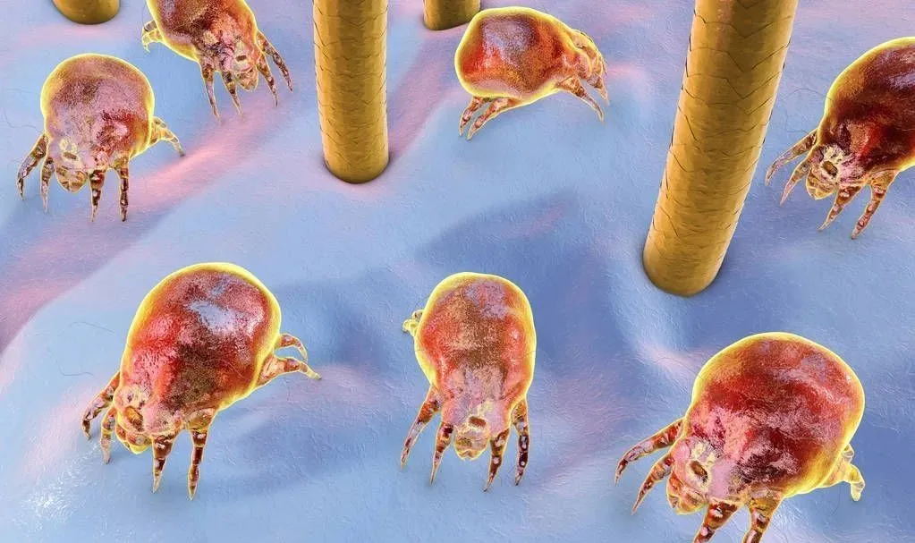 去头皮角质的正确方法,头皮角质层去除用什么方法