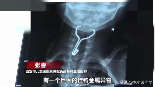 小孩误吞塑料异物怎么帮助排出来,宝宝误吞金属挂钩