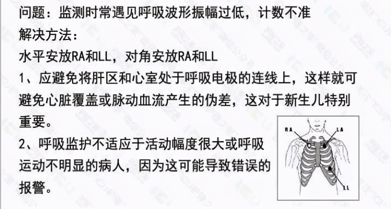 心电监护使用的收费标准,心电监护使用年限