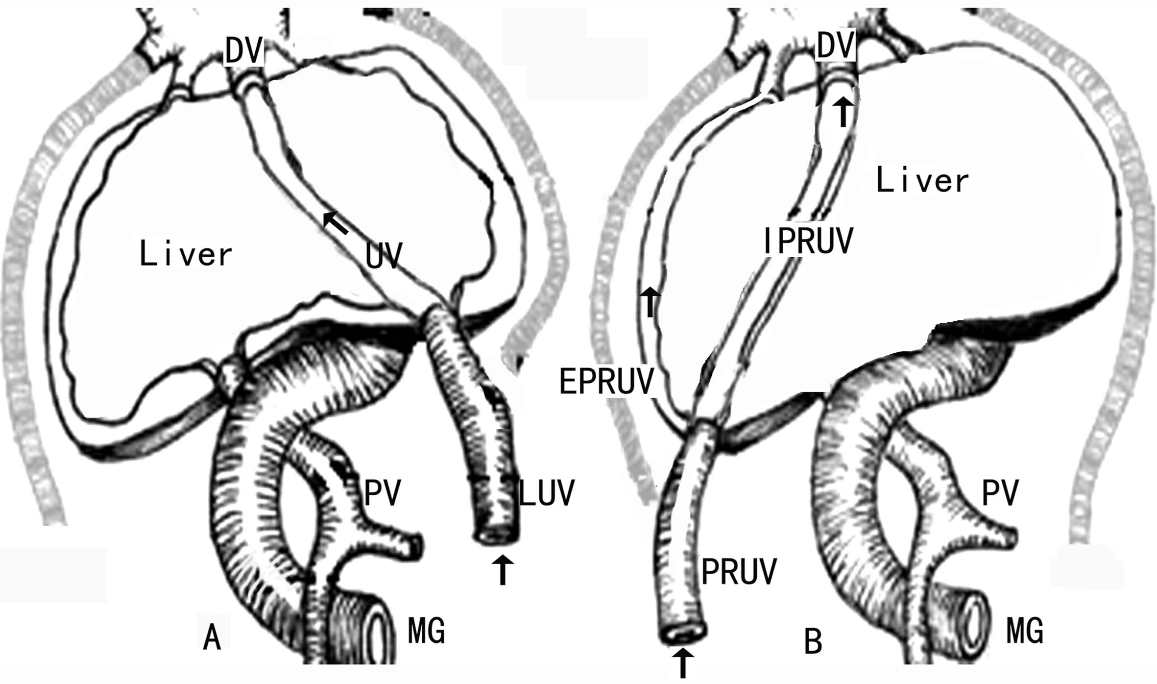 做彩超可以看出来脐带多长吗,超声检查脐带绕颈一圈正常吗
