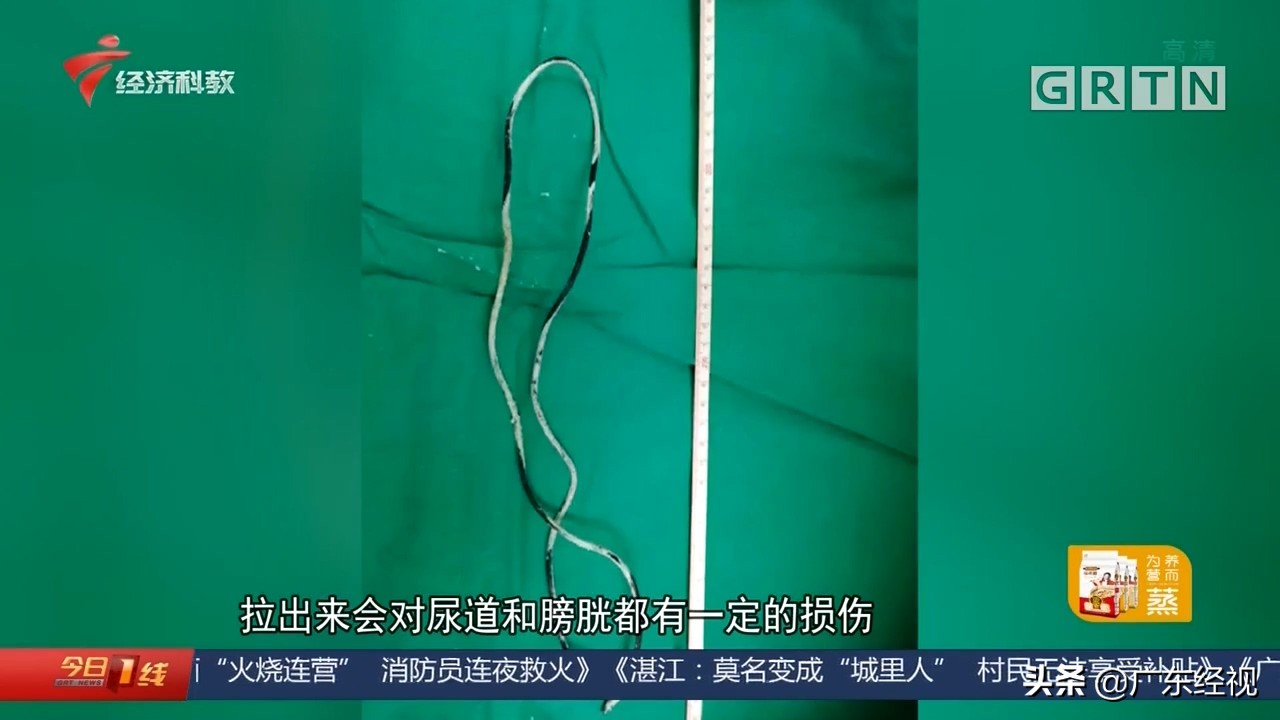 尿液从何来？东莞13岁男孩“好奇探索”险出大事