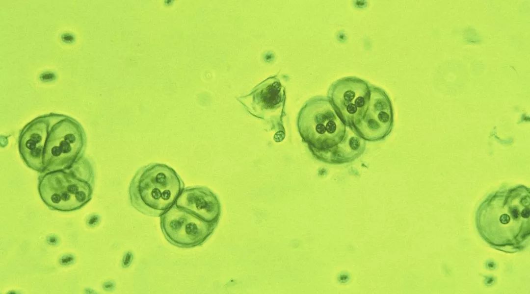 蓝藻这么复杂是如何诞生的,蓝藻有多伟大