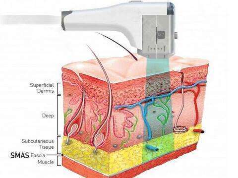鑰佺帇闈㈤儴鍙樼編,鑰佺帇鏁欎綘鍙樼編