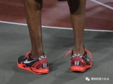 刚崴脚是要冷敷还是热敷,崴脚后24小时内是热敷还是冷敷