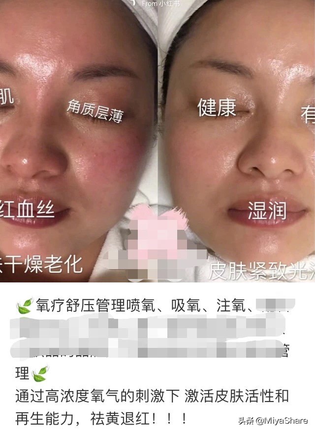 美容注氧仪是智商税吗,注氧仪是智商税吗有什么用
