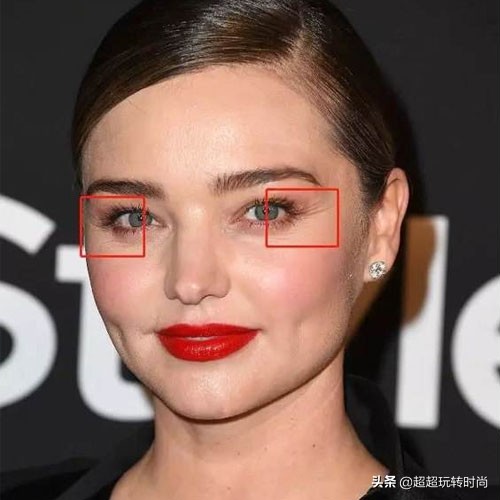 女人人中最近出现了皱纹,女人脸上有明显的皱纹是多少岁了