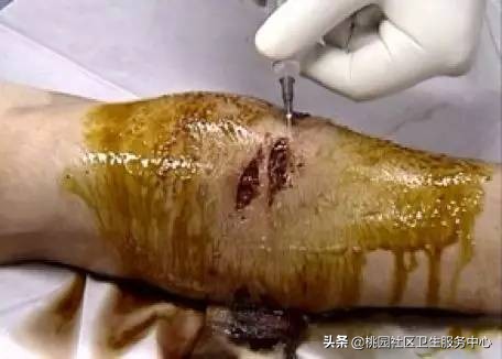 为啥鼠兔咬伤不用打狂犬疫苗,老鼠咬伤要不要打狂犬疫苗