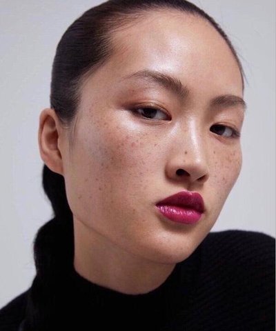 雀斑激光祛斑需要几次才能祛干净,有什么办法可以祛雀斑不反弹