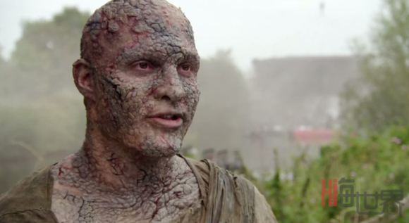 《权力的游戏》：可怕的灰鳞病