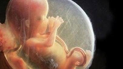 羊水量偏多孕妈有哪些症状,羊水量胎儿状态