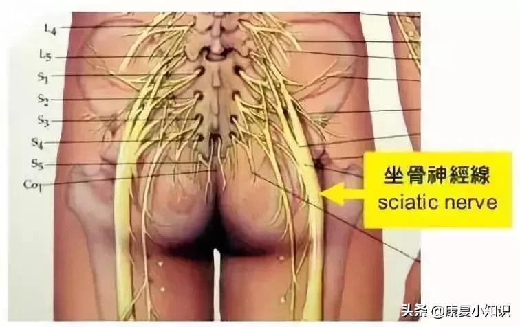 坐骨神经痛按摩哪些穴位,坐骨神经痛吃什么食物好