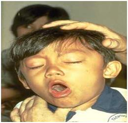 小孩一天到晚反复咳怎么办,孩子总是反复生病妈妈自责