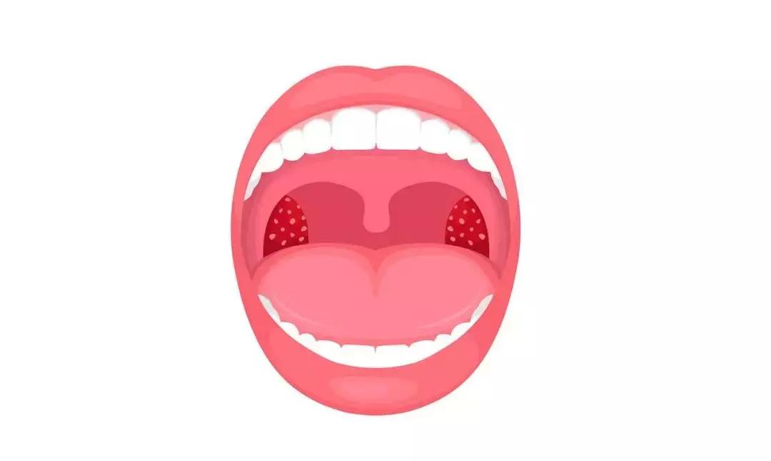 治疗扁桃体炎怎么快速见效,慢性扁桃体炎怎么治疗好得快