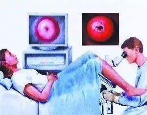 HPV疫苗不能代替宫颈癌筛查,这样做才保险!