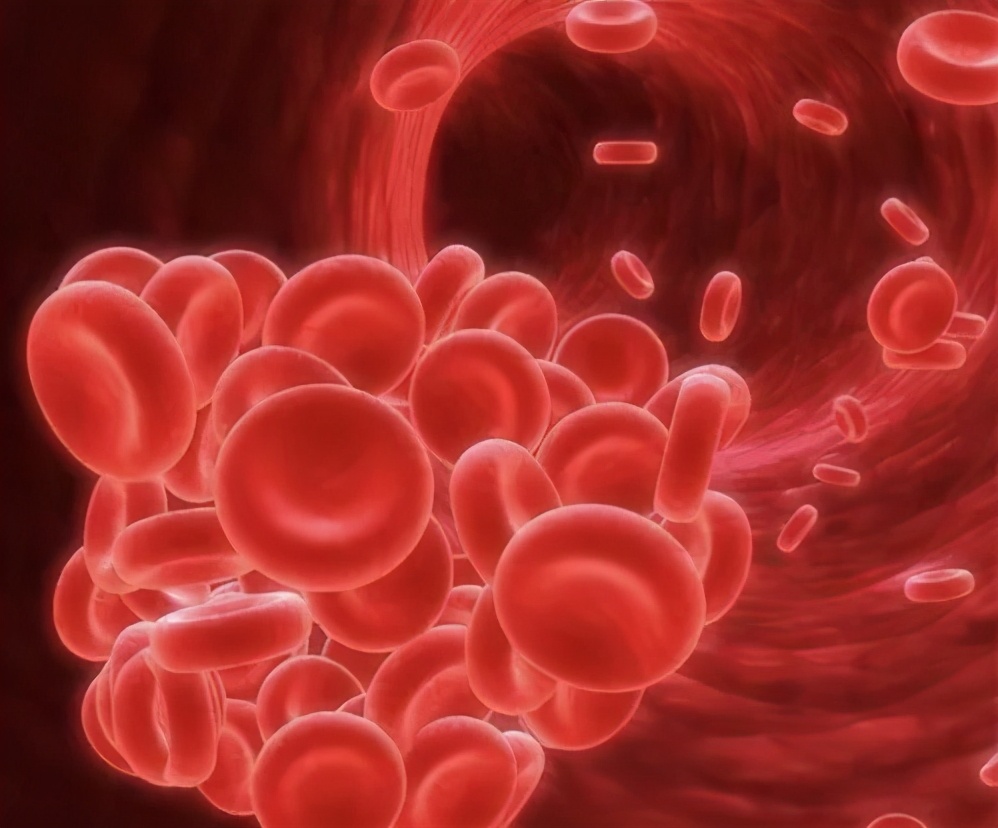 妊娠缺铁性贫血的并发症,婴儿严重贫血有生命危险吗