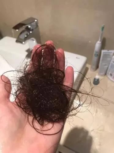 女生掉头发严重,女生掉头发怎么安慰