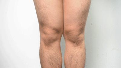 冬天觉得膝盖特别冷解决方法,膝盖冷一招搞定