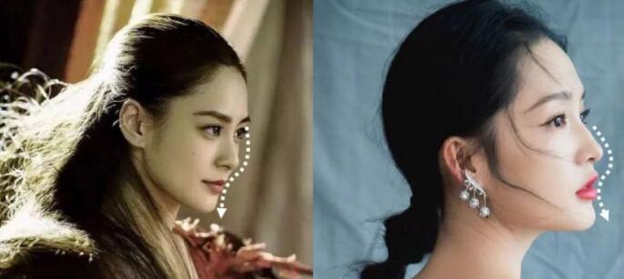 面部一枝花全靠鼻当家,论鼻子对颜值的重要性▼