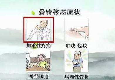 肝癌骨转移疼痛如何止痛,骨转移疼痛用什么药治疗疗效最好