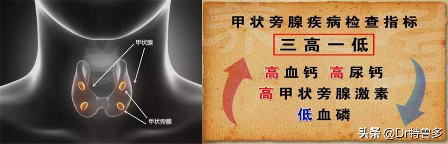 骨折能避开灾祸是迷信么,骨折恢复后腿有坑是怎么回事