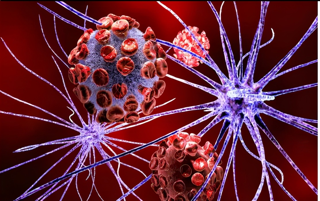 亨廷顿氏舞蹈症诊断方法,亨廷顿氏舞蹈症最新研究成果