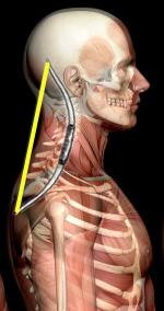 颈椎生理曲度过曲是啥意思,颈椎生理弯曲变直反弓怎么治疗