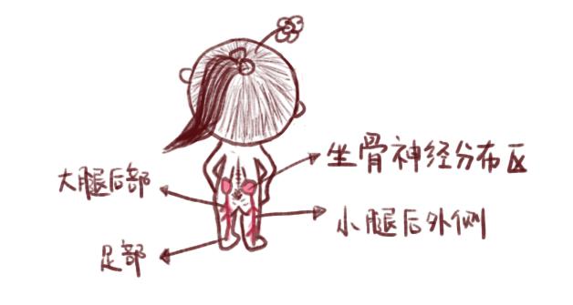 孕期耻骨痛坐骨神经痛,孕妇坐骨神经耻骨痛怎么缓解