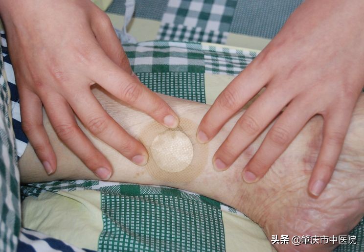 外痔用什么药好,外治法