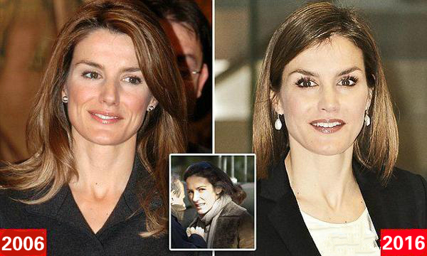 凯特王妃整形了吗,王妃凯特有没有整容